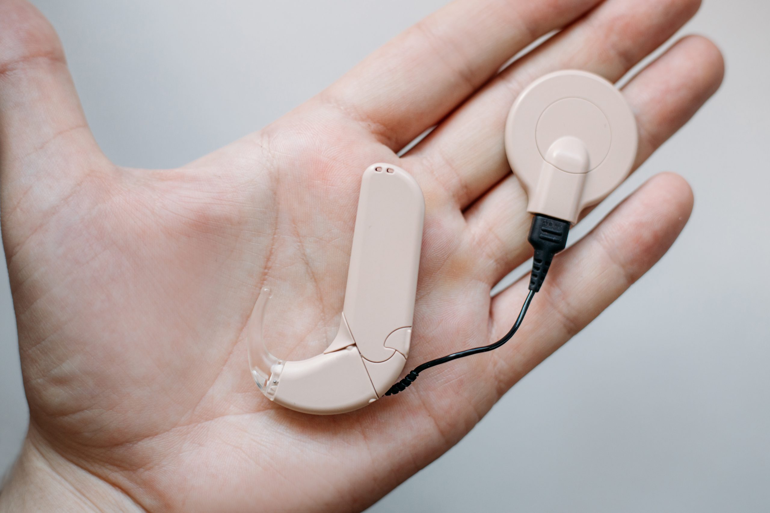 The Benefits of Cochlear Implants for Hearing Loss