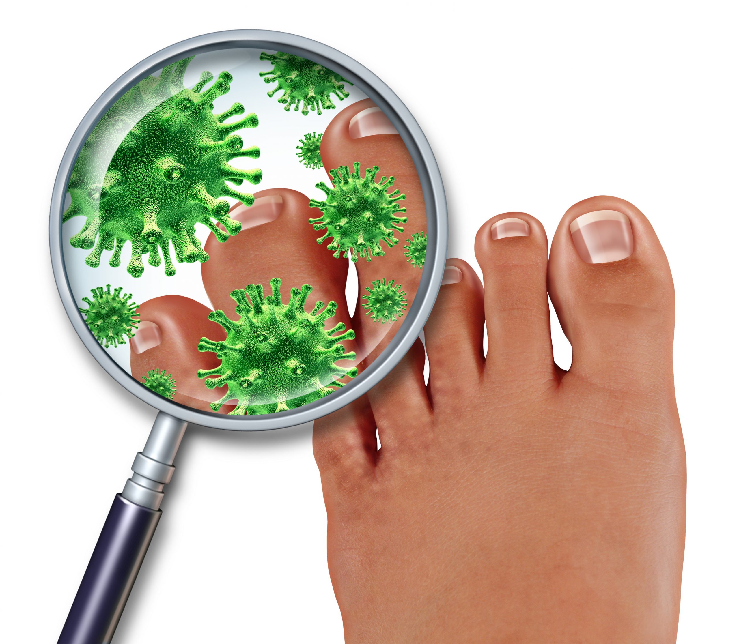 Tips for Toenail Fungus Prevention in Athletes