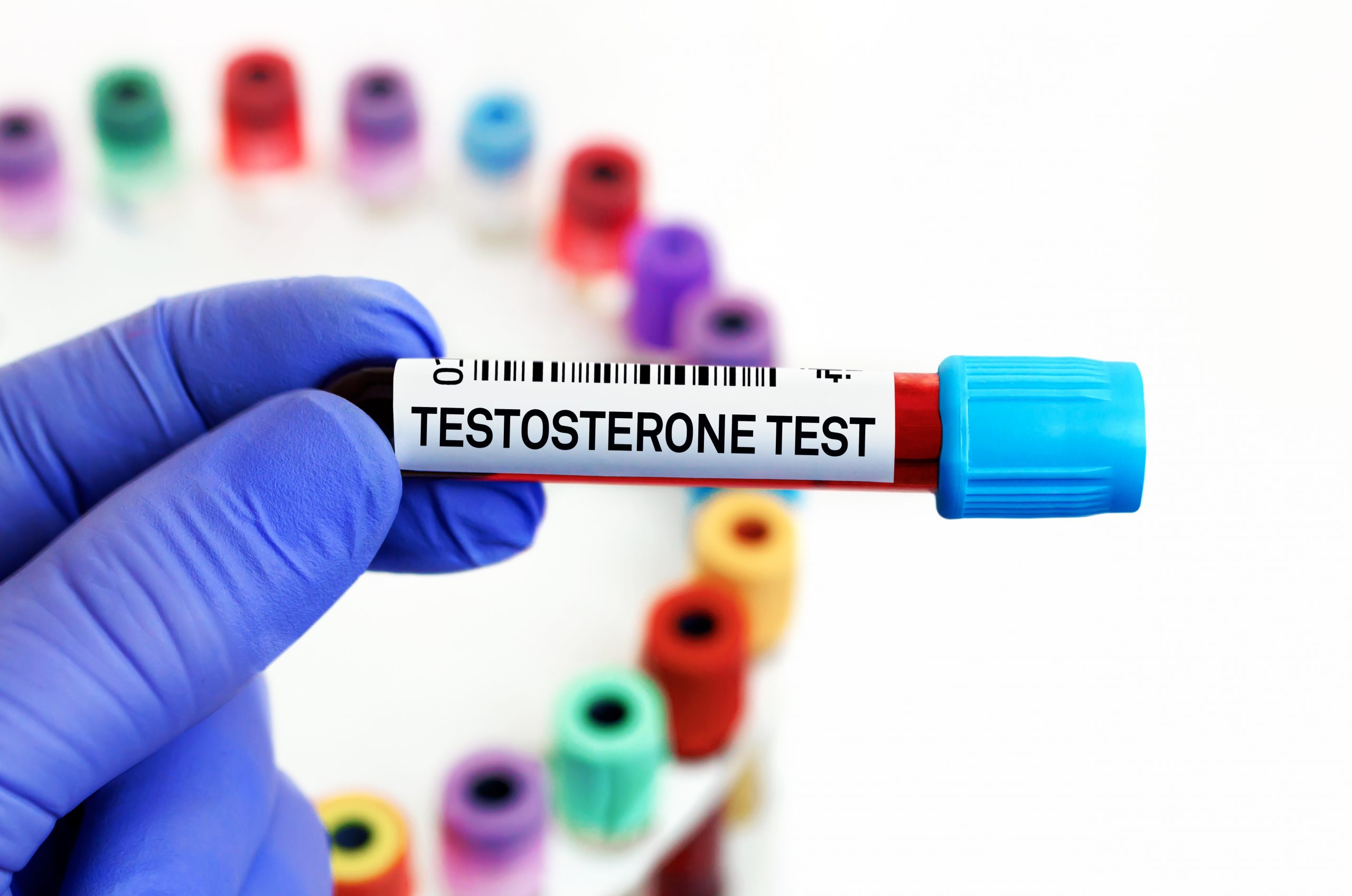 The connection between prostate health and testosterone levels