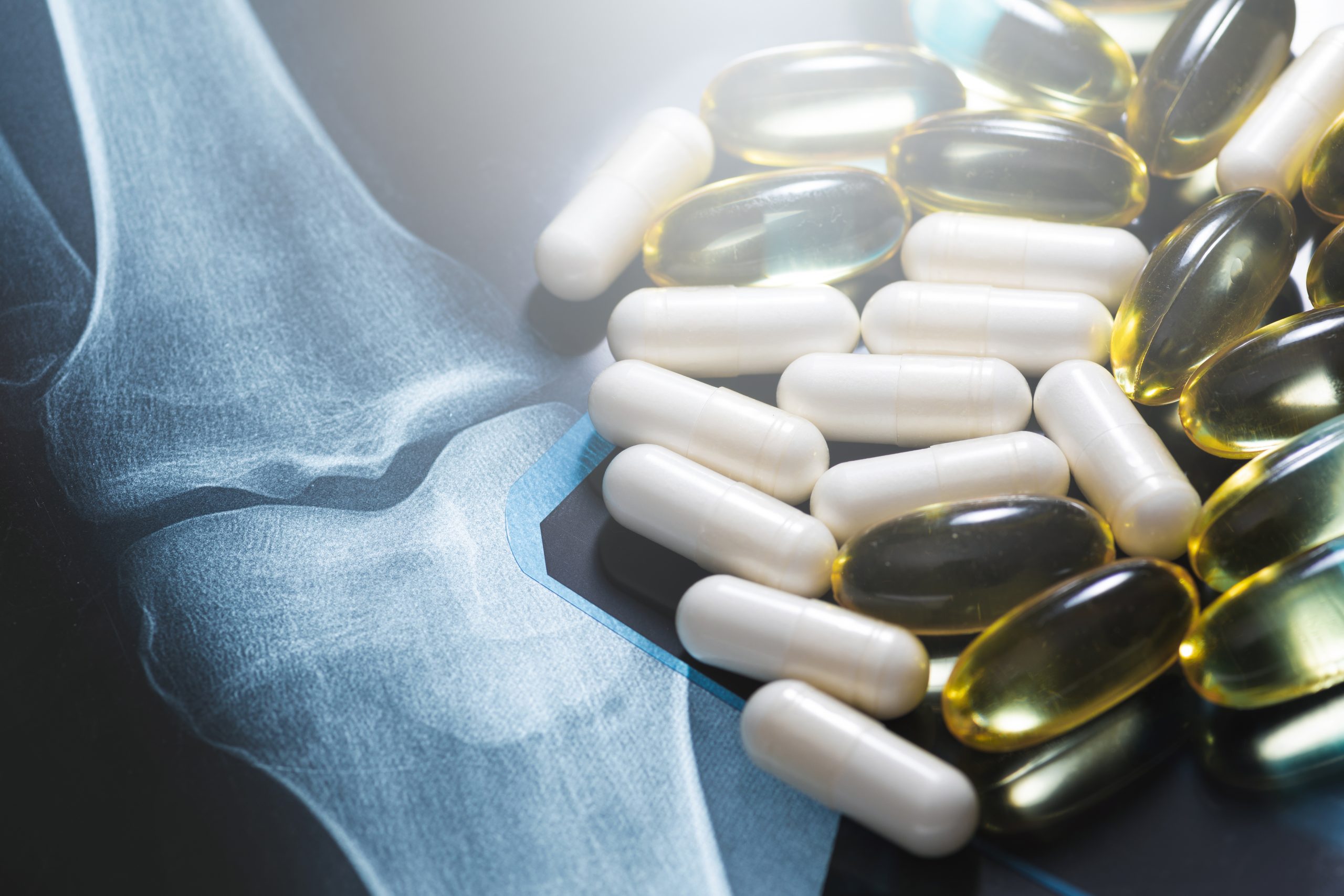 Supplements for Joint Health and Pain Relief